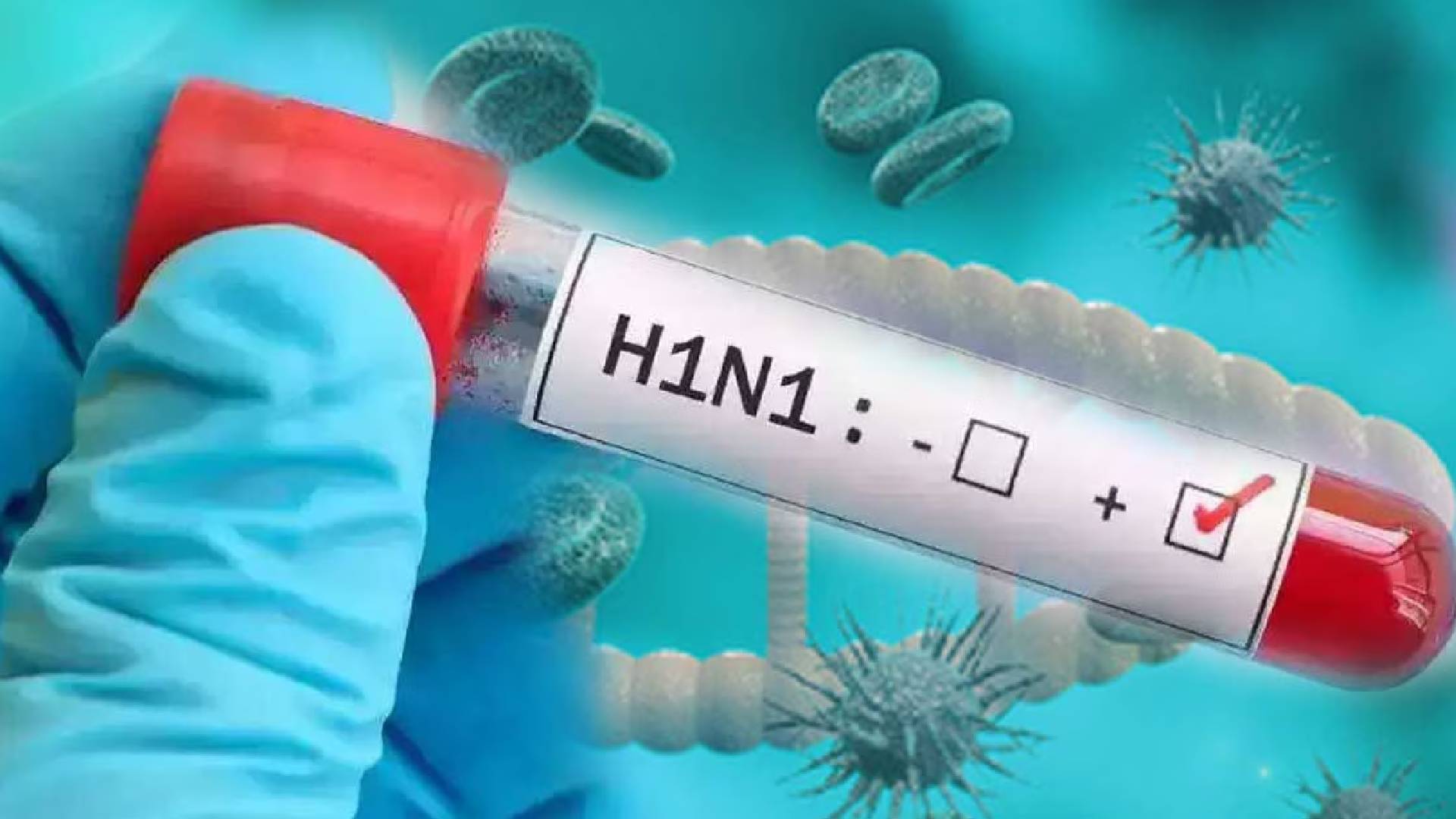 Swine Flu Alert